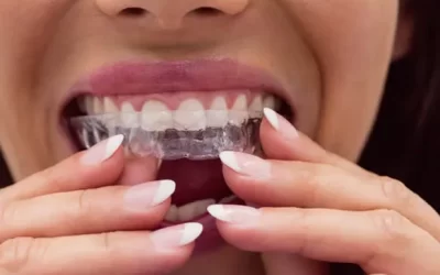 Invisalign Providence: Clear Aligner Therapy for Discreet Orthodontic Correction